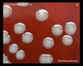 klebsiella pneumoniae colonies on blood agar